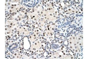 PSME3 antibody was used for immunohistochemistry at a concentration of 4-8 ug/ml to stain Epithelial cells of renal tubule (arrows) in Human Kidney. (PSME3 Antikörper  (N-Term))