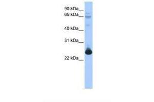 Image no. 1 for anti-Transcription Elongation Factor A (SII)-Like 1 (TCEAL1) (C-Term) antibody (ABIN6737839)