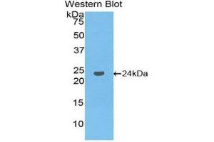 Western Blotting (WB) image for anti-Guanine Nucleotide Binding Protein (G Protein), beta Polypeptide 1-Like (GNB1L) (AA 69-247) antibody (ABIN1858969)
