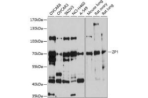 Western blot analysis of extracts of various cell lines, using ZP1 antibody (ABIN6130973, ABIN6150532, ABIN6150533 and ABIN6214972) at 1:1000 dilution. (ZP1 Antikörper  (AA 340-610))