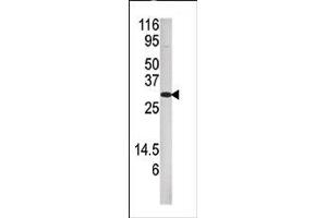 Image no. 1 for anti-Dual Specificity Phosphatase 3 (DUSP3) (N-Term) antibody (ABIN360840) (Dual Specificity Phosphatase 3 (DUSP3) (N-Term) Antikörper)