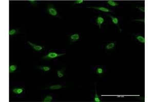 Immunofluorescence of monoclonal antibody to HES2 on HeLa cell.