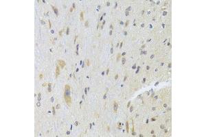 Immunohistochemistry of paraffin-embedded rat spinal cord using DPP3 Antibody. (DPP3 Antikörper  (AA 1-280))
