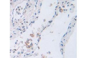 Used in DAB staining on fromalin fixed paraffin- embedded Kidney tissue (PCDH20 Antikörper  (AA 64-209))