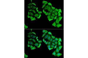 Immunofluorescence analysis of HeLa cell using C4BPB antibody. (C4BPB Antikörper)