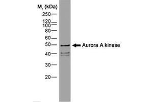 Image no. 1 for anti-Aurora Kinase A (AURKA) (N-Term) antibody (ABIN206445) (Aurora A Antikörper  (N-Term))