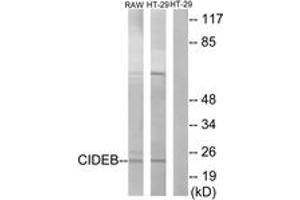 Western blot analysis of extracts from HT-29/RAW264. (CIDEB Antikörper  (AA 91-140))