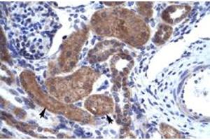 Immunohistochemical staining (Formalin-fixed paraffin-embedded sections) of human kidney with IKZF2 polyclonal antibody  at 4-8 ug/mL working concentration. (IKZF2 Antikörper  (C-Term))