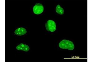 Immunofluorescence of monoclonal antibody to HLF on HeLa cell. (HLF Antikörper  (AA 1-295))