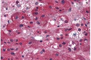Human Adrenal (formalin-fixed, paraffin-embedded) stained with ARIH1 antibody ABIN337340 at 5 ug/ml followed by biotinylated anti-goat IgG secondary antibody ABIN481715, alkaline phosphatase-streptavidin and chromogen. (ARIH1 Antikörper  (AA 513-526))
