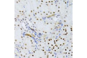 Immunohistochemistry of paraffin-embedded mouse kidney using SNRNP70 antibody. (SNRNP70 Antikörper  (AA 150-250))