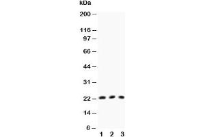 Western blot testing of TNFb antibody and Lane 1:  HeLa;  2: MCF-7;  3: COLO320 (LTA Antikörper  (AA 45-59))