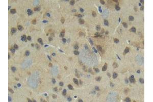 IHC-P analysis of Mouse Cerebrum Tissue, with DAB staining. (CTGF Antikörper  (AA 245-346))