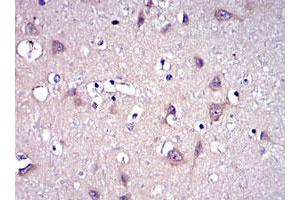 Immunohistochemical analysis of paraffin-embedded human brain tissues using MMP9 monoclonal antibody, clone 5G3  with DAB staining. (MMP 9 Antikörper)