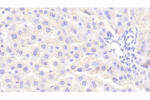 Immunohistochemistry (IHC) image for anti-Nuclear Receptor Subfamily 0, Group B, Member 2 (NR0B2) (AA 1-260) antibody (ABIN7444745)