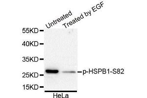 Western Blotting (WB) image for anti-Heat Shock 27kDa Protein 1 (HSPB1) (pSer82) antibody (ABIN3023550) (HSP27 Antikörper  (pSer82))