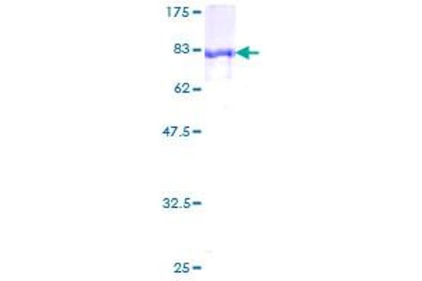 ALDH6A1 Protein (AA 10-535) (GST tag)