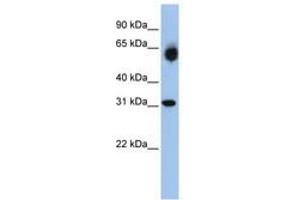 Image no. 1 for anti-Dehydrogenase/reductase (SDR Family) Member 2 (DHRS2) (AA 108-157) antibody (ABIN6740754) (DHRS2 Antikörper  (AA 108-157))