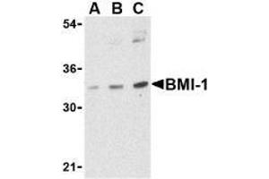 Western blot analysis of BMI-1 in K562 cell lysate with AP30158PU-N BMI-1 antibody at (A) 0.