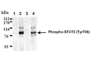 Western Blotting (WB) image for anti-Signal Transducer and Activator of Transcription 3 (Acute-Phase Response Factor) (STAT3) (AA 703-714), (pTyr705), (pTyr708) antibody (ABIN1449165) (STAT3 Antikörper  (pTyr705, pTyr708))