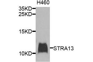 Western blot analysis of extracts of H460 cells, using STRA13 antibody. (STRA13 Antikörper)