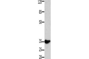 Western Blotting (WB) image for anti-Homeobox A11 (HOXA11) antibody (ABIN2431519) (Homeobox A11 Antikörper)