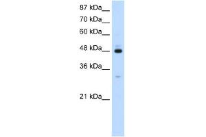 WB Suggested Anti-PAIP1 Antibody Titration:  1. (PAIP1 Antikörper  (C-Term))