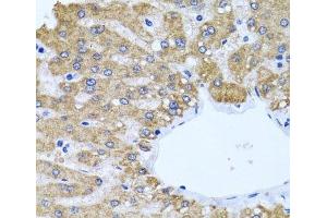 Immunohistochemistry of paraffin-embedded Human liver using CCM2 Polyclonal Antibody at dilution of 1:100 (40x lens). (CCM2 Antikörper)