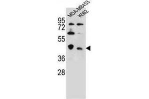 CTBP1 Antibody (C-term) western blot analysis in MDA-MB453,K562 cell line lysates (35µg/lane). (CTBP1 Antikörper  (C-Term))