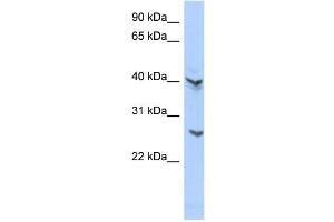 WB Suggested Anti-ATP6V0E2 Antibody Titration: 0.