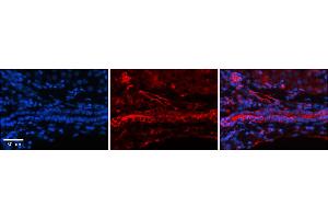 Immunohistochemistry (IHC) image for anti-Folate Receptor 1 (Adult) (FOLR1) (Middle Region) antibody (ABIN2776804)