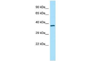 WB Suggested Anti-TMOD4 Antibody Titration: 1. (Tropomodulin 4 Antikörper  (Middle Region))