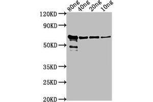 Western Blot Positive WB detected in Recombinant protein All lanes: VP2 antibody at 1:2000 Secondary Goat polyclonal to rabbit IgG at 1/50000 dilution Predicted band size: 62 kDa Observed band size: 62 kDa (VP2 (AA 1-216) Antikörper)