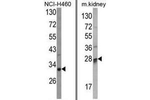 Image no. 1 for anti-Catechol-O-Methyltransferase Domain Containing 1 (COMTD1) (C-Term) antibody (ABIN452860)