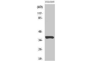 Western Blotting (WB) image for anti-Olfactory Receptor, Family 52, Subfamily B, Member 2 (OR52B2) (Internal Region) antibody (ABIN6281850)