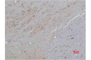 Immunohistochemistry (IHC) analysis of paraffin-embedded Rat Brain Tissue using CACNB3 Polyclonal Antibody.