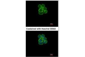 ICC/IF Image Immunofluorescence analysis of methanol-fixed A431, using SGLT1, antibody at 1:500 dilution. (SLC5A1 Antikörper  (Center))