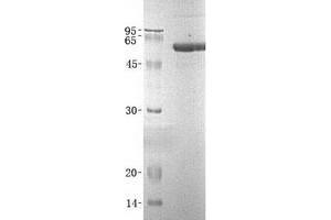 Validation with Western Blot (Arylsulfatase A Protein (ARSA) (Transcript Variant 1) (His tag))