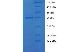 SDS-PAGE (SDS) image for Tissue Factor Pathway Inhibitor (Lipoprotein-Associated Coagulation Inhibitor) (TFPI) (AA 25-300) protein (His tag) (ABIN5710478) (TFPI Protein (AA 25-300) (His tag))