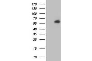 Western Blotting (WB) image for anti-V-Akt Murine Thymoma Viral Oncogene Homolog 1 (AKT1) antibody (ABIN1496557)