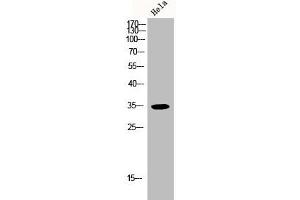 Western Blot analysis of HELA cells using p35 Polyclonal Antibody (CDK5R1 Antikörper  (N-Term))