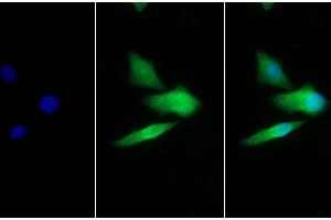 Detection of GLa in Human Hela cell using Polyclonal Antibody to Galactosidase Alpha (GLa) (GLA Antikörper  (AA 147-371))