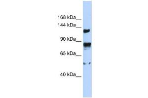 TRPM4 antibody used at 1 ug/ml to detect target protein. (TRPM4 Antikörper  (N-Term))