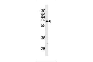 Western blot analysis of in NCI-H460 cell line lysates (35ug/lane) (KRT9 Antikörper  (AA 429-456))