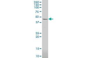 LRRC2 polyclonal antibody (A01), Lot # 060717JCS1. (LRRC2 Antikörper  (AA 272-371))