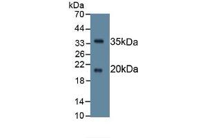 Detection of Recombinant SPINK5, Human using Monoclonal Antibody to Serine Peptidase Inhibitor Kazal Type 5 (SPINK5) (SPINK5 Antikörper  (AA 699-976))