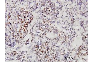 Immunostaining (ISt) image for anti-Ribosomal RNA Processing 9, Small Subunit (SSU) Processome Component, Homolog (RRP9) (AA 1-475) antibody (ABIN563952)