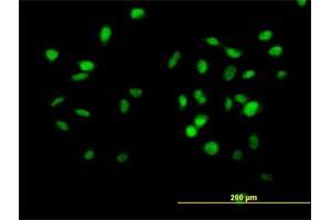 Immunofluorescence of purified MaxPab antibody to CUL4B on HeLa cell. (Cullin 4B Antikörper  (AA 1-913))