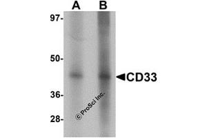 Western Blotting (WB) image for anti-CD33 (CD33) (Middle Region) antibody (ABIN1030903) (CD33 Antikörper  (Middle Region))
