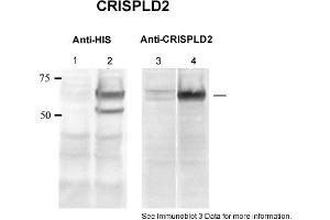 Sample type: 1. (CRISPLD2 Antikörper  (N-Term))